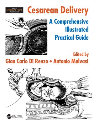 cover image of Cesarean Delivery